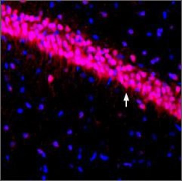 抗-钾通道 Kv4.3 兔抗 affinity isolated antibody, lyophilized powder