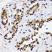 Anti-ILF2 Antibody, clone 5P1K2, Rabbit Monoclonal