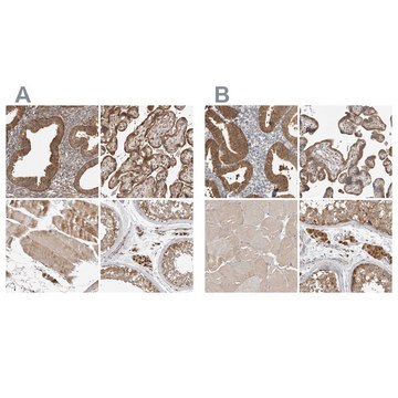 Anti-KYAT3 antibody produced in rabbit Prestige Antibodies&#174; Powered by Atlas Antibodies, affinity isolated antibody, buffered aqueous glycerol solution, Ab1