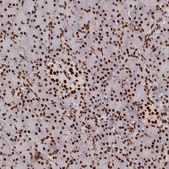 Anti-PRPF31 antibody produced in rabbit Prestige Antibodies® Powered by Atlas Antibodies, affinity isolated antibody, buffered aqueous glycerol solution