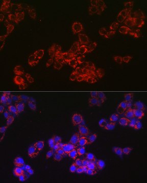 Anti-ACAA2 Antibody, clone 8H6H5, Rabbit Monoclonal