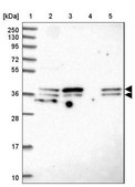 Anti-SUGT1 antibody produced in rabbit Prestige Antibodies® Powered by Atlas Antibodies, affinity isolated antibody, buffered aqueous glycerol solution