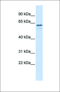 Anti-TRIM6 (ab1) antibody produced in rabbit affinity isolated antibody