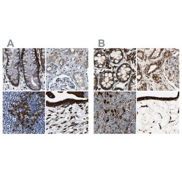 Anti-RRBP1 antibody produced in rabbit Prestige Antibodies&#174; Powered by Atlas Antibodies, affinity isolated antibody, buffered aqueous glycerol solution