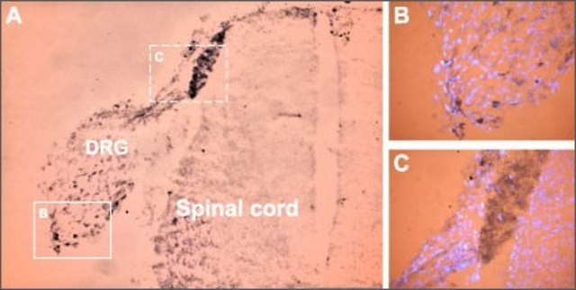 Anti-Sodium Channel NaV1.9 antibody produced in rabbit affinity isolated antibody, lyophilized powder