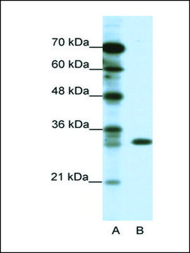 Anti-TSFM (AB2) antibody produced in rabbit IgG fraction of antiserum