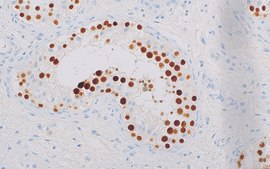 MAGEC2 (EP405) Rabbit Monoclonal Primary Antibody