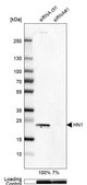 Anti-HN1 antibody produced in rabbit Prestige Antibodies® Powered by Atlas Antibodies, affinity isolated antibody, buffered aqueous glycerol solution