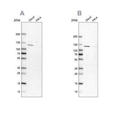 Anti-LEMD3 antibody produced in rabbit Prestige Antibodies&#174; Powered by Atlas Antibodies, affinity isolated antibody, buffered aqueous glycerol solution