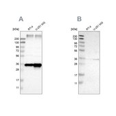 Anti-SSR1 antibody produced in rabbit Prestige Antibodies® Powered by Atlas Antibodies, affinity isolated antibody, buffered aqueous glycerol solution