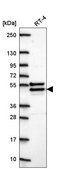 Anti-CHST14 antibody produced in rabbit Prestige Antibodies® Powered by Atlas Antibodies, affinity isolated antibody