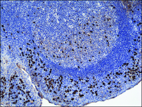 Anti-Human IgA1 antibody, Rabbit monoclonal recombinant, expressed in HEK 293 cells, clone RM124, purified immunoglobulin