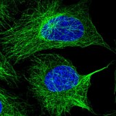 Anti-TUBA1A antibody produced in rabbit Prestige Antibodies® Powered by Atlas Antibodies, affinity isolated antibody, buffered aqueous glycerol solution