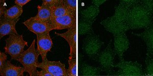 Anti-phospho-Stat1-Tyr701 Antibody, clone 1F23 ZooMAb® Rabbit Monoclonal recombinant, expressed in HEK 293 cells