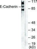 Anti-Cadherin-pan antibody produced in rabbit affinity isolated antibody