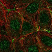 Anti-PAK4 antibody produced in rabbit Prestige Antibodies&#174; Powered by Atlas Antibodies, affinity isolated antibody