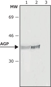 Monoclonal Anti-&#945;1-Acid Glycoprotein antibody produced in mouse clone AGP-47, ascites fluid