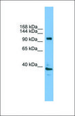 Anti-ATP6V0A1, (C-terminal) antibody produced in rabbit affinity isolated antibody