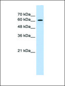 Anti-ZIC2 antibody produced in rabbit affinity isolated antibody