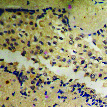 Anti-phospho-Akt (pTyr474) antibody produced in rabbit affinity isolated antibody