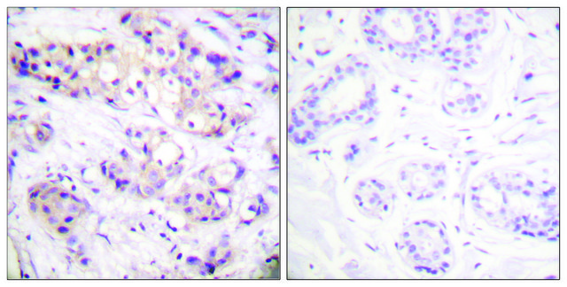 Anti-PKC &#945; antibody produced in rabbit affinity isolated antibody