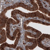 Monoclonal Anti-CARS antibody produced in mouse Prestige Antibodies® Powered by Atlas Antibodies, clone CL2309, purified immunoglobulin, buffered aqueous glycerol solution