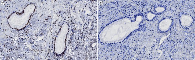 Anti-m3G/TMG cap Antibody, clone K121 ZooMAb&#174; Mouse Monoclonal recombinant, expressed in HEK 293 cells