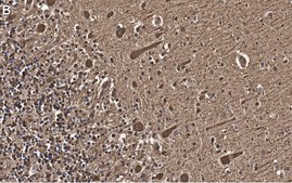 Anti-Aldolase C Antibody, clone 3B18, ZooMAb® Rabbit Monoclonal recombinant, expressed in HEK 293 cells