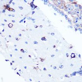 Anti-YB-1/YBX1 antibody produced in rabbit