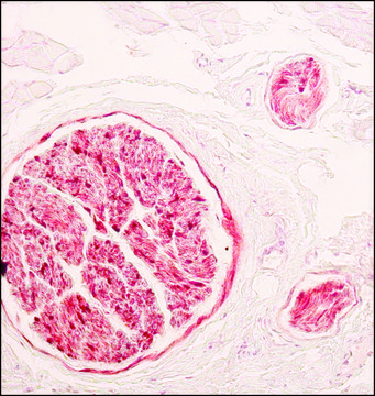 Monoclonal Anti-S-100 (&#946;-Subunit) antibody produced in mouse clone SH-B4, ascites fluid