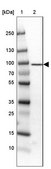 Anti-TARS antibody produced in rabbit Prestige Antibodies® Powered by Atlas Antibodies, affinity isolated antibody, buffered aqueous glycerol solution