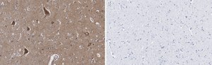 Anti-BSN Antibody, clone 2I2 ZooMAb® Rabbit Monoclonal recombinant, expressed in HEK 293 cells
