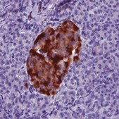 Monoclonal Anti-TSPAN7 antibody produced in mouse Prestige Antibodies® Powered by Atlas Antibodies, clone CL0262, purified immunoglobulin, buffered aqueous glycerol solution