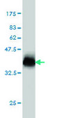 Monoclonal Anti-NPC1 antibody produced in mouse clone 4H2, purified immunoglobulin, buffered aqueous solution