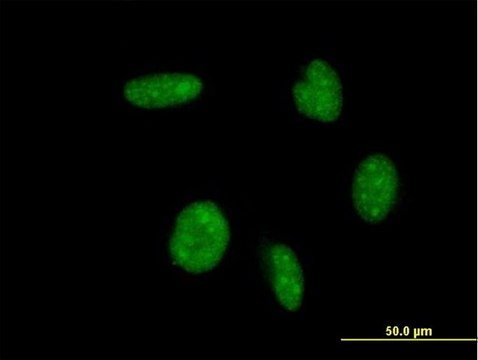 ANTI-ATOH1 antibody produced in mouse clone 4H2, purified immunoglobulin, buffered aqueous solution