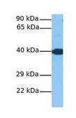 Anti-MOGAT1 antibody produced in rabbit affinity isolated antibody