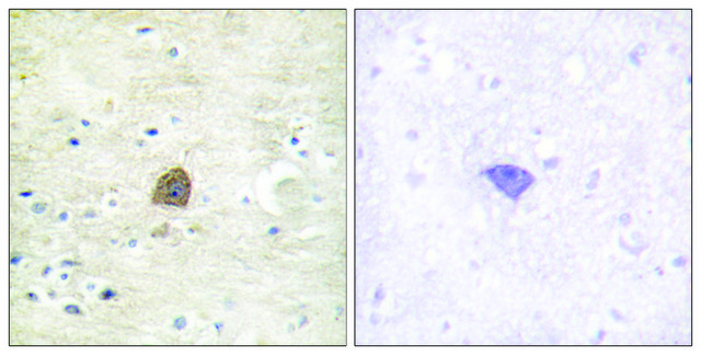 Anti-phospho-CaMK2&#945;/&#946;/&#948; (pThr305) antibody produced in rabbit affinity isolated antibody