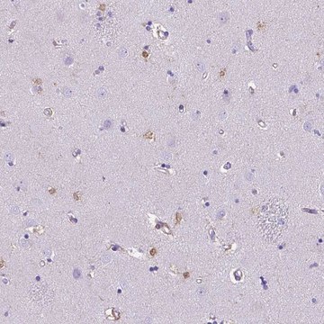 Anti-TMEM169 antibody produced in rabbit Prestige Antibodies&#174; Powered by Atlas Antibodies, affinity isolated antibody, buffered aqueous glycerol solution