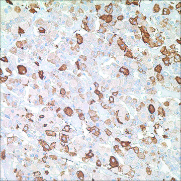 TSH Rabbit Polyclonal Antibody