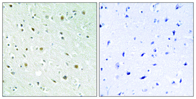 Anti-SSBP2 antibody produced in rabbit affinity isolated antibody