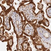 Anti-PLEKHA1 antibody produced in rabbit Prestige Antibodies® Powered by Atlas Antibodies, affinity isolated antibody, buffered aqueous glycerol solution