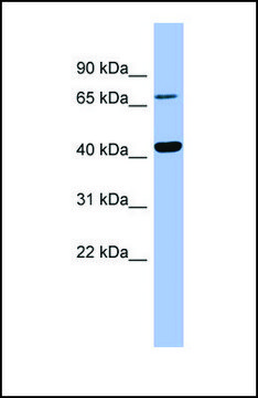 Anti-HPD antibody produced in rabbit affinity isolated antibody