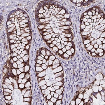 Anti-ZNF813 antibody produced in rabbit Prestige Antibodies&#174; Powered by Atlas Antibodies, affinity isolated antibody, buffered aqueous glycerol solution