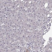 Anti-B3GNT6 antibody produced in rabbit Prestige Antibodies® Powered by Atlas Antibodies, affinity isolated antibody, buffered aqueous glycerol solution