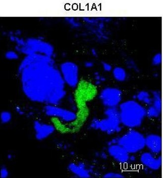 Anti-COL1A1 (C-terminal) antibody produced in rabbit affinity isolated antibody