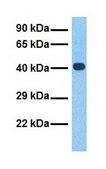 Anti-CYTB antibody produced in rabbit affinity isolated antibody