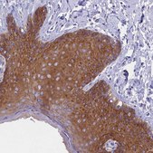 Anti-PPP1R13L antibody produced in rabbit Prestige Antibodies® Powered by Atlas Antibodies, affinity isolated antibody, buffered aqueous glycerol solution