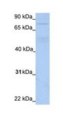 Anti-JPH3 antibody produced in rabbit affinity isolated antibody