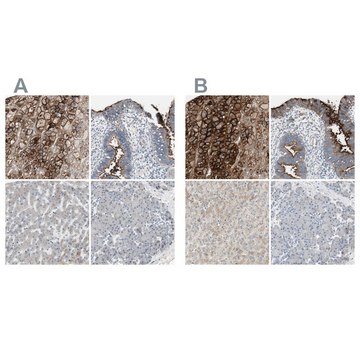 Anti-ALPL antibody produced in rabbit Ab1, Prestige Antibodies&#174; Powered by Atlas Antibodies, affinity isolated antibody, buffered aqueous glycerol solution