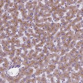 Anti-APOE antibody produced in rabbit Prestige Antibodies® Powered by Atlas Antibodies, affinity isolated antibody, buffered aqueous glycerol solution
